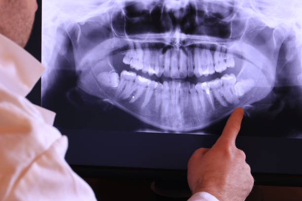 Best Emergency Dentist for Knocked-Out Tooth in Garyville, LA