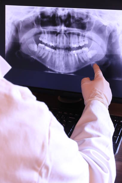 Best Emergency Dental Extractions in Garyville, LA